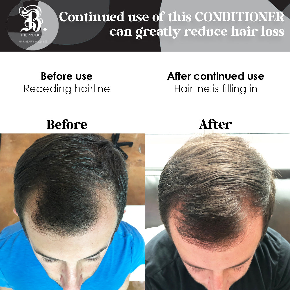 Biotin & Vitamin Conditioner For Hair Growth