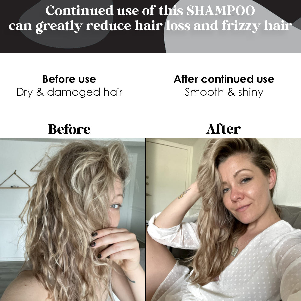 Biotin & Vitamin Shampoo, Conditioner & Hair Growth Serum, Box Set